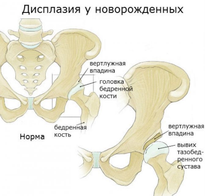 Заболевание
